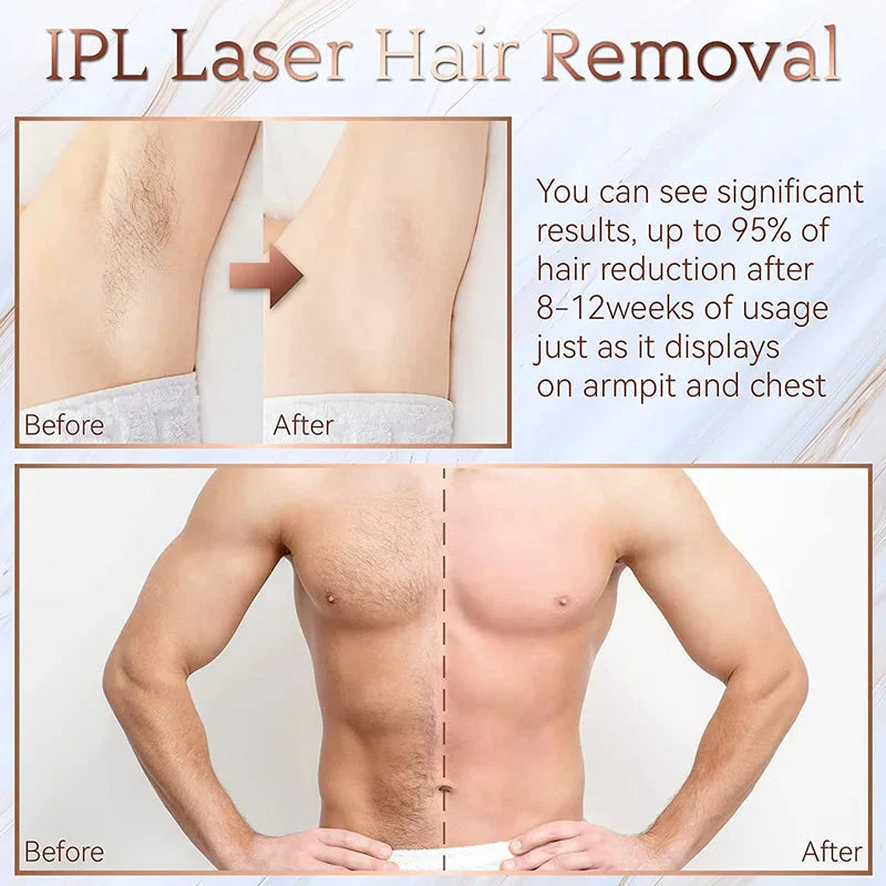 999,999 Flashes IPL Laser Epilator – Painless Hair Removal for Women